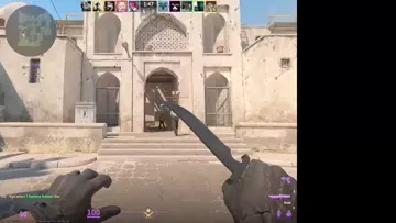 Pistol Ace (kıskanç oe beni vurdu)