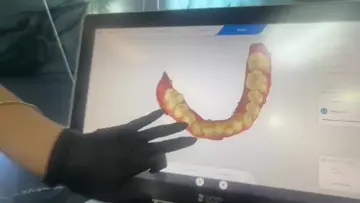 teeth 1