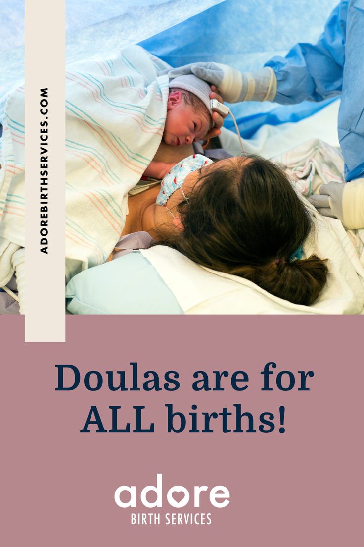 Many people think that doulas are only for mamas who opt for