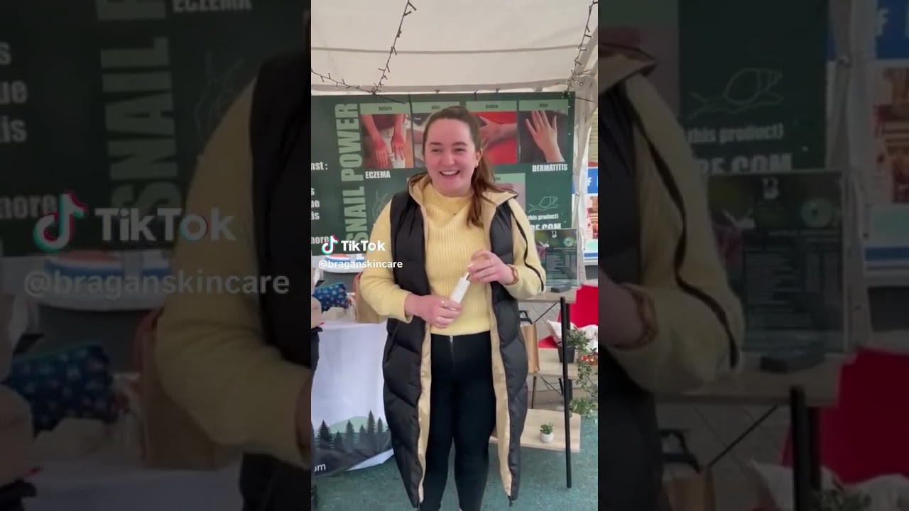 Sinead said goodbye to Eczema