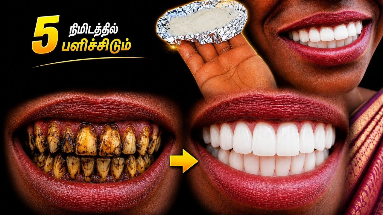 இது தெரிஞ்சா 5 நிமிடத்தில் மஞ்சள் பற்கள் வெண்மையாகும் சீக்ரெட் ! teeth whitening