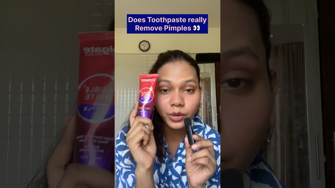 Toothpaste removes pimples #shorts#explore #makeup #grwn#hack#myth #reality