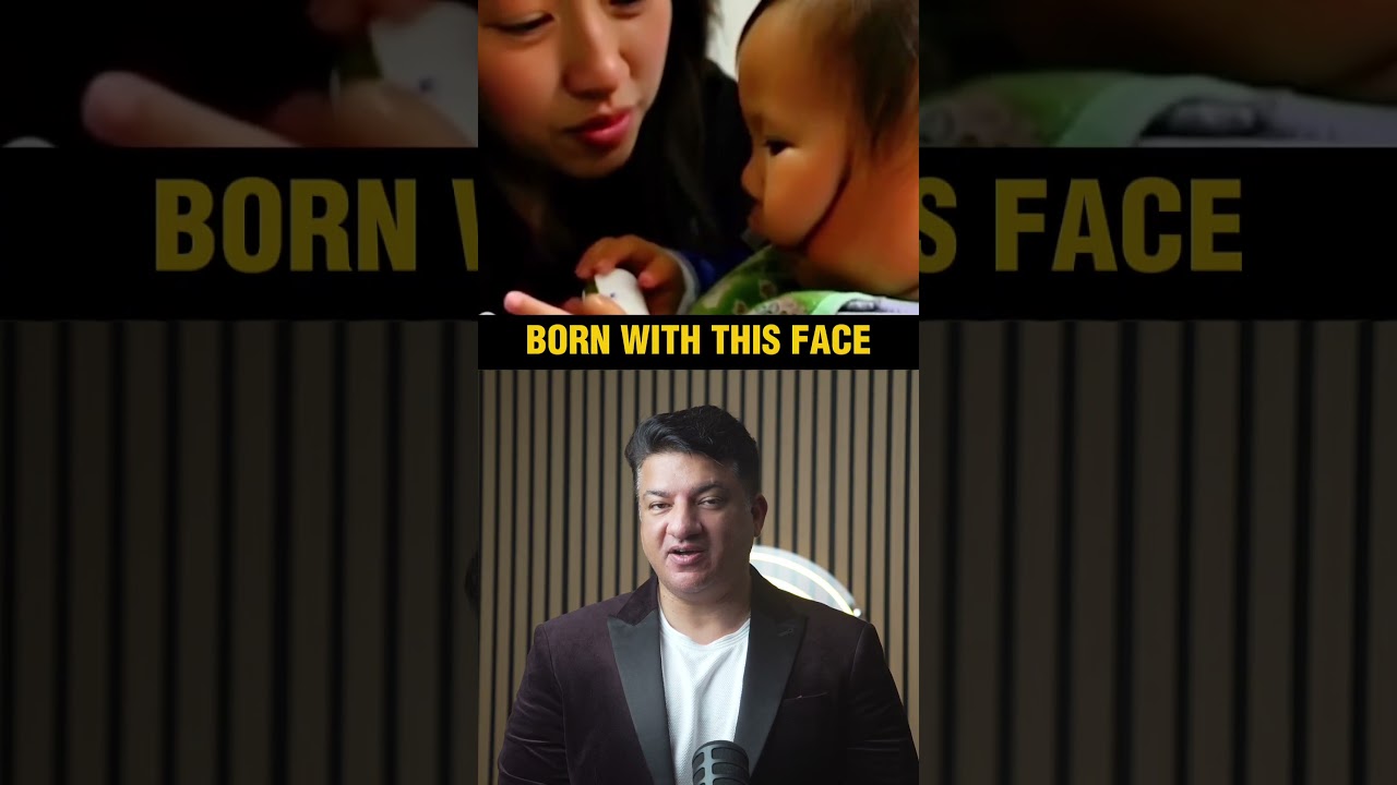 😢 Baby Born With A Snake Like Face Shocked Doctors  Incredible Transformation  Latest Update