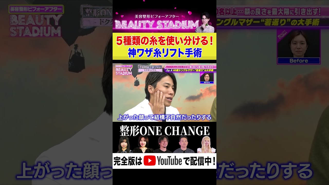 【美容整形】５種類の糸を使い分ける糸リフト手術！神ワザ手術に密着！