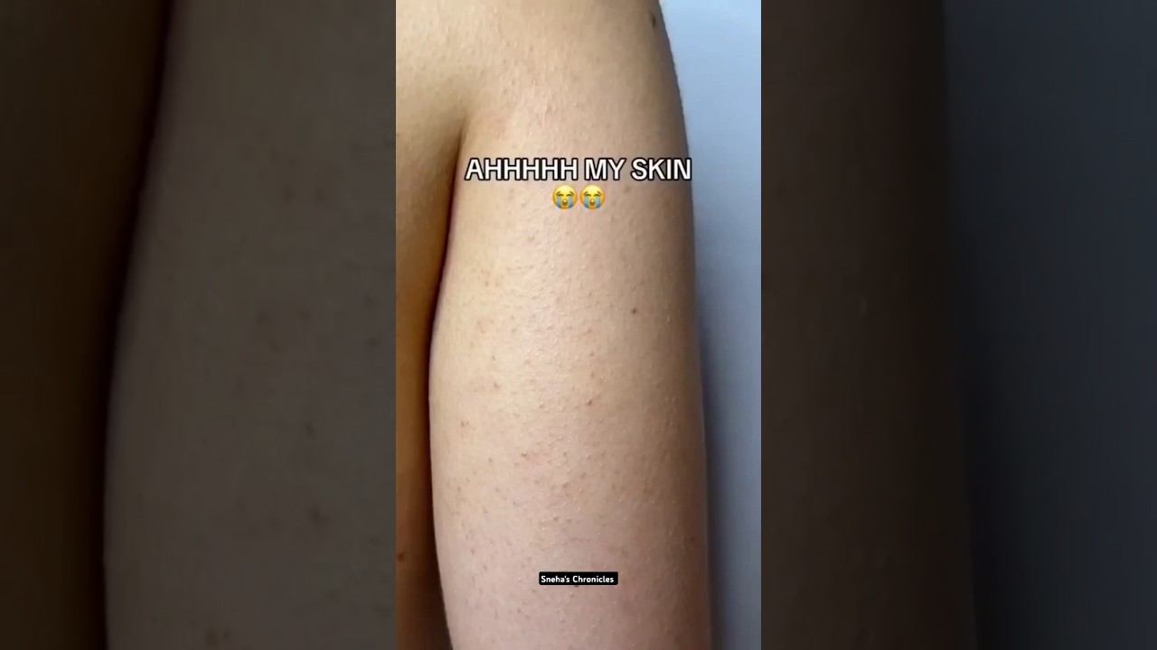 Body Scrub | How to remove strawberry legs #bodyscrub #diy #aesthetic #shorts