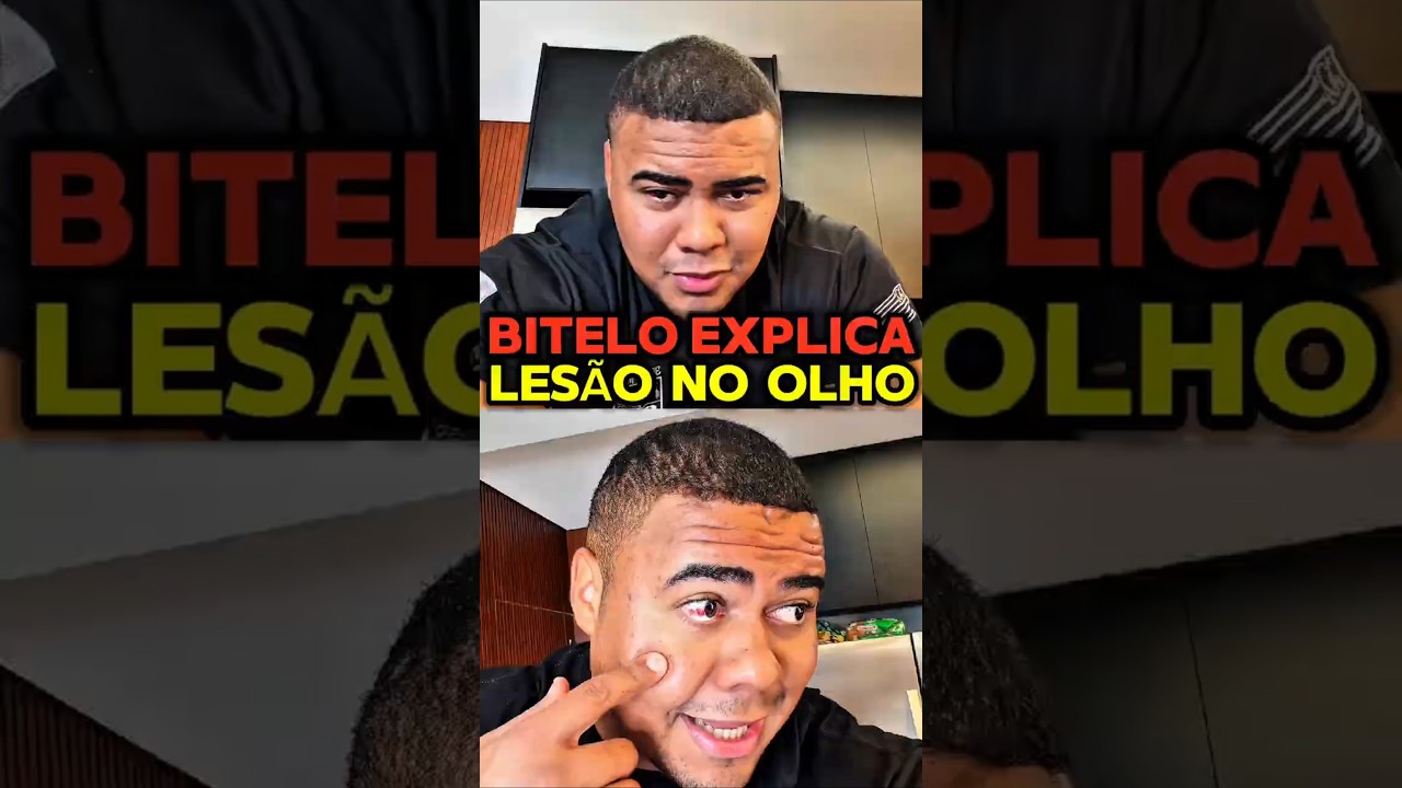 BITELO EXPLICA LESÃO NO OLHO APÓS COMPETIÇÃO #bodybuilding #bitelo #olympia #shorts
