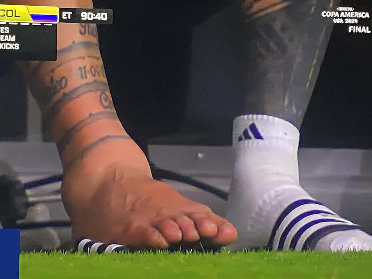 Lionel Messi’s ankle is absolutely destroyed